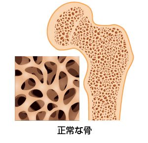 正常な骨